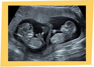 in Manchester and Lancashire Into the Blue Little Monkey 4D Baby Scan Gift Experience Voucher